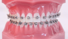 orthodontics-course